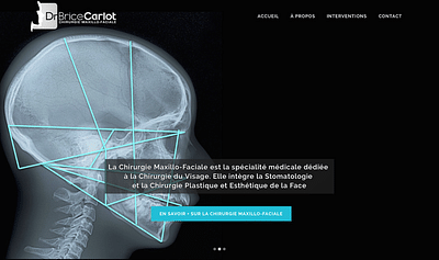Site internet pour un chirurgien maxillo facial - Création de site internet