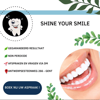 Shine Your Smile - Social Media Management - Réseaux sociaux