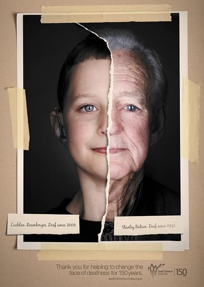 Changing the face of deafness - Publicité