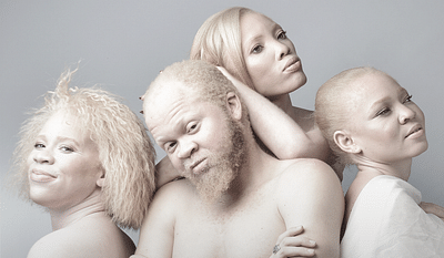 It's Just A Color (Sensibilisation à l'Albinisme) - Onlinewerbung