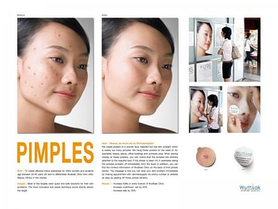 Pimples - Publicité