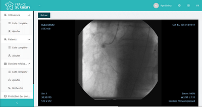 MRI viewer - Health - Innovación