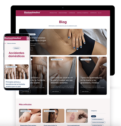 Diseño Blog Blastoestimulina - Ergonomy (UX/UI)