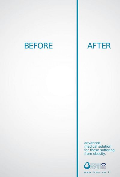 before after - Werbung
