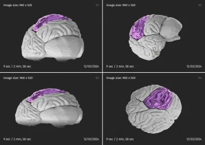 3D Medical Imaging Software Development - Software Development