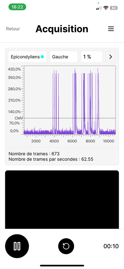 EMIL Physio / Ergo - Développement de Logiciel