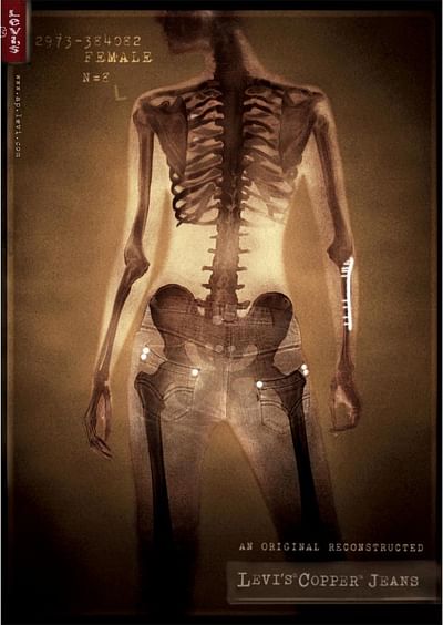 X-ray Female - Publicité
