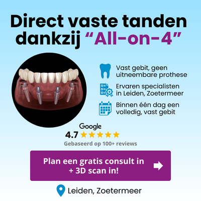 Leadgeneratie voor Implantaatbehandelingen - Online Advertising