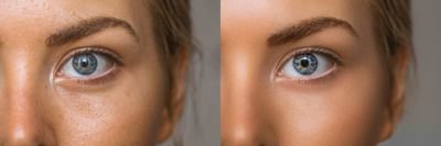 Skin Retouching - Graphic Design