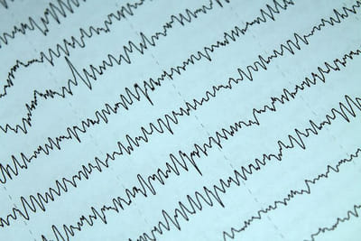 Automatic Epileptic Seizure Detection on EEG Brainwaves - Artificial Intelligence